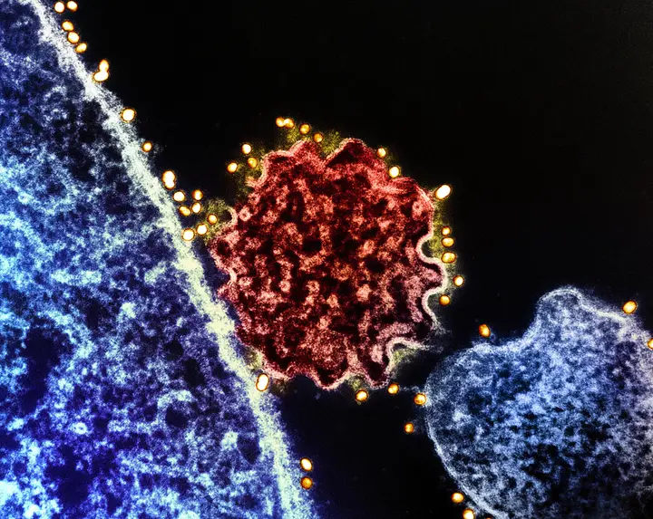 Vírus Nipah: o surto que é mortal em metade dos casos